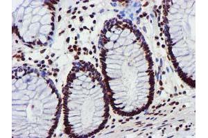 Image no. 9 for anti-Glutathione S-Transferase theta 2 (GSTT2) antibody (ABIN1498553) (GSTT2 antibody)