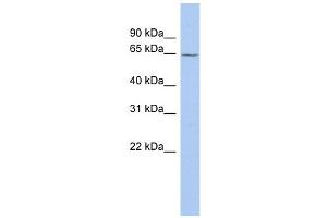 MAOA antibody used at 1 ug/ml to detect target protein. (Monoamine Oxidase A antibody  (Middle Region))