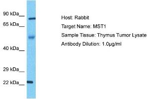 Host: Rabbit Target Name: MST1 Sample Type: Thymus Tumor lysates Antibody Dilution: 1. (MST1 antibody  (N-Term))
