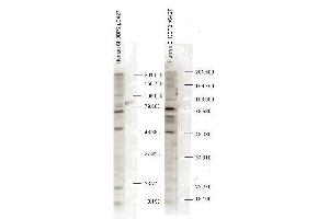 Western blot analysis is shown using anti-SH3BP2 pS427 antibody to detect endogenous protein present in unstimulated human whole cell lysates). (SH3BP2 antibody  (pSer427))