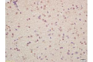 Formalin-fixed and paraffin embedded mouse brain labeled with Anti-Musashi 1/Msi1 Polyclonal Antibody, Unconjugated (ABIN1387744) at 1:200 followed by conjugation to the secondary antibody and DAB staining (Musashi 1/2 (AA 66-150) antibody)