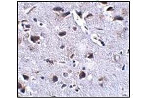 Immunohistochemistry of RCAN2 in mouse brain tissue with this product at 2. (RCAN2 antibody  (Center))