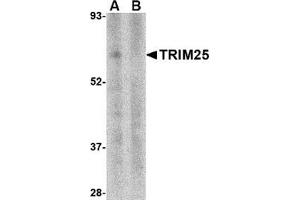 Western blot analysis of TRIM25 in human thymus tissue lysate in (A) the absence and (B) presence of blocking peptide with this product at 1 μg/ml. (TRIM25 antibody  (N-Term))