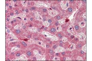 Human Liver (formalin-fixed, paraffin-embedded) stained with RBP1followed by biotinylated anti-goat IgG secondary antibody, alkaline phosphatase-streptavidin and chromogen. (RBP1 antibody  (C-Term))