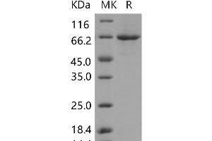 Western Blotting (WB) image for Polo-Like Kinase 1 (PLK1) (Active) protein (His tag) (ABIN7320008) (PLK1 Protein (His tag))