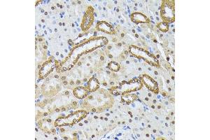 Immunohistochemistry of paraffin-embedded mouse kidney using SMN1 antibody (ABIN7270652) at dilution of 1:100 (40x lens). (SMN1 antibody  (AA 80-150))