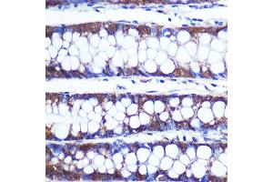 Immunohistochemistry of paraffin-embedded Human colon using TOP1MT Rabbit pAb (ABIN7270851) at dilution of 1:100 (40x lens). (TOP1MT antibody  (AA 470-550))