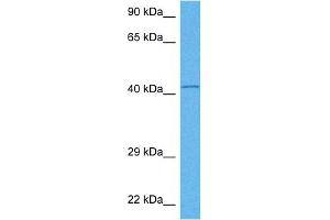 Western Blotting (WB) image for anti-Isocitrate Dehydrogenase 2 (NADP+), Mitochondrial (IDH2) (Middle Region) antibody (ABIN2783282)