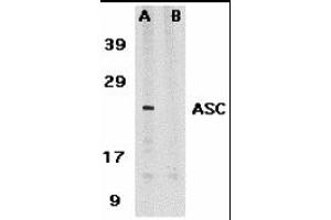 Western Blotting (WB) image for anti-Steroid Sulfatase (STS) antibody (ABIN1031704) (STS antibody)