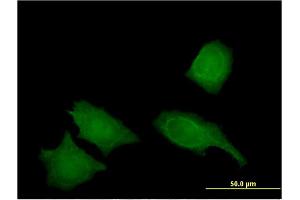 Immunofluorescence of monoclonal antibody to IREB2 on HeLa cell. (IREB2 antibody  (AA 1-343))