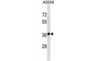 Western Blotting (WB) image for anti-TruB Pseudouridine (Psi) Synthase Homolog 2 (TRUB2) antibody (ABIN3001393) (TRUB2 antibody)