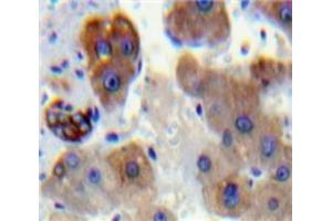 IHC-P analysis of Liver tissue, with DAB staining. (PNPLA2 antibody  (AA 481-702))