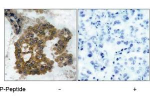 Image no. 1 for anti-V-Akt Murine Thymoma Viral Oncogene Homolog 2 (AKT2) (pSer474) antibody (ABIN196826) (AKT2 antibody  (pSer474))