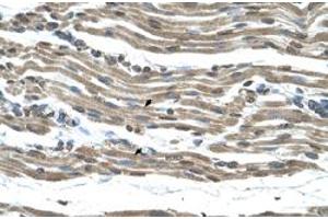 Immunohistochemical staining (Formalin-fixed paraffin-embedded sections) of human muscle with COX15 polyclonal antibody  at 4-8 ug/mL working concentration. (COX15 antibody  (N-Term))