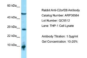 WB Suggested Anti-C2orf28 Antibody   Titration: 1.