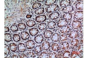 Immunohistochemistry (IHC) analysis of paraffin-embedded Human Colon, antibody was diluted at 1:100.