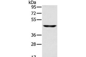 Western Blot analysis of Human fetal brain tissue using SLC16A8 Polyclonal Antibody at dilution of 1:200