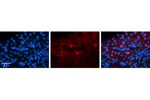 Rabbit Anti-MLX Antibody   Formalin Fixed Paraffin Embedded Tissue: Human Liver Tissue Observed Staining: Nucleus in hepatocytes Primary Antibody Concentration: 1:100 Other Working Concentrations: N/A Secondary Antibody: Donkey anti-Rabbit-Cy3 Secondary Antibody Concentration: 1:200 Magnification: 20X Exposure Time: 0. (MLX antibody  (Middle Region))