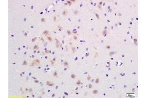 Formalin-fixed and paraffin embedded rat brain labeled with Rabbit Anti JNK1/2/3 Polyclonal Antibody, Unconjugated (ABIN747713) at 1:200 followed by conjugation to the secondary antibody and DAB staining (JNK antibody  (AA 151-250))