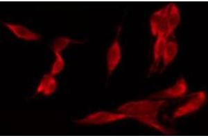 ABIN6267429 staining HeLa by IF/ICC. (NFKB1 antibody  (pSer932))