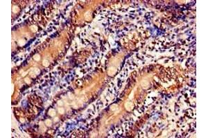 Immunohistochemistry of paraffin-embedded human small intestine tissue using ABIN7175158 at dilution of 1:100 (USP6NL antibody  (N-Term))