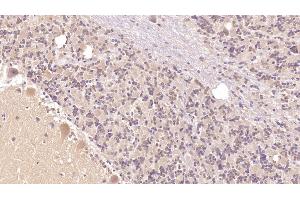 Detection of PTHR2 in Human Cerebellum Tissue using Monoclonal Antibody to Parathyroid Hormone Receptor 2 (PTHR2) (PTH2R antibody  (AA 27-145))