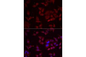Immunofluorescence analysis of U2OS cell using PFKFB3 antibody. (PFKFB3 antibody)