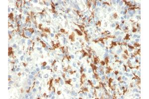 Formalin-fixed, paraffin-embedded human Kidney stained with AIF1 / Iba1 Mouse Monoclonal Antibody (AIF1/2493). (Iba1 antibody  (AA 1-146))