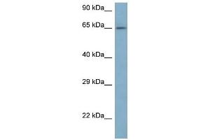 Western Blot showing ARFGAP3 antibody used at a concentration of 1 ug/ml against 721_B Cell Lysate (ARFGAP3 antibody  (N-Term))