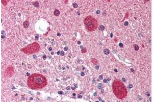 Human Brain, Cerebellum (formalin-fixed, paraffin-embedded) stained with STK11 antibody ABIN214519 at 5 ug/ml followed by biotinylated goat anti-rabbit IgG secondary antibody ABIN481713, alkaline phosphatase-streptavidin and chromogen. (LKB1 antibody  (N-Term))