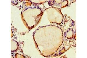 Immunohistochemistry of paraffin-embedded human thyroid tissue using ABIN7167828 at dilution of 1:100
