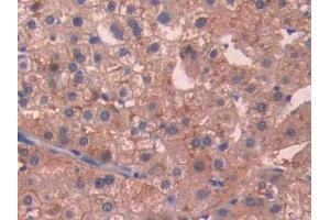 DAB staining on IHC-P; Samples: Human Liver Tissue (SIGIRR antibody  (AA 1-118))