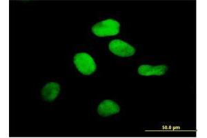 Immunofluorescence of purified MaxPab antibody to RCC1 on HeLa cell. (RCC1 antibody  (AA 1-421))