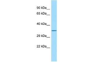 Host: Rabbit Target Name: FAM49B Sample Type: HT1080 Whole Cell lysates Antibody Dilution: 1. (FAM49B antibody  (C-Term))