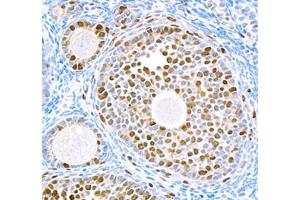 Immunohistochemistry (Paraffin-embedded Sections) (IHC (p)) image for anti-Topoisomerase (DNA) II alpha 170kDa (TOP2A) antibody (ABIN7075937)