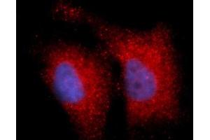 Immunofluorescence (IF) image for anti-Integrin beta 1 (ITGB1) (AA 21-461) antibody (APC) (ABIN5566381)