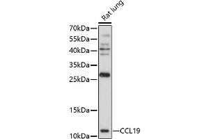 Western blot analysis of extracts of rat lung, using CCL19 antibody (ABIN7266300) at 1:1000 dilution. (CCL19 antibody  (AA 22-95))