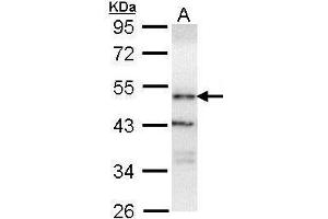 OSBPL1A antibody  (C-Term)