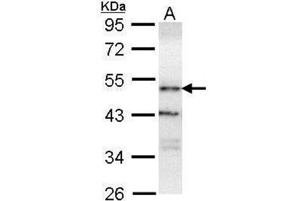 OSBPL1A antibody  (C-Term)