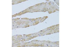Immunohistochemistry of paraffin-embedded mouse heart using TRAP1 Antibody (ABIN1875197) at dilution of 1:100 (40x lens). (TRAP1 antibody)