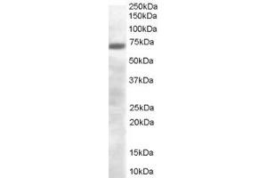 ABIN185299 (0. (PRDM4 antibody  (C-Term))