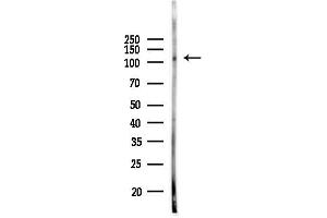 Western blot analysis of lysates from PC12 cells, using Phospho-NF (Ser165) Antibody at 1/1000 dilution.