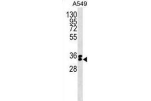 Western Blotting (WB) image for anti-F-Box Protein 44 (FBXO44) antibody (ABIN5019782) (FBXO44 antibody)