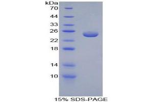 SDS-PAGE analysis of Mouse Peroxiredoxin 5 Protein.