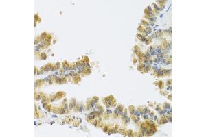 Immunohistochemistry of paraffin-embedded mouse lung using NMU antibody (ABIN6290689) at dilution of 1:100 (40x lens). (Neuromedin U antibody)