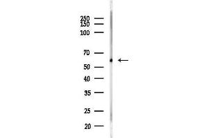 anti-24-Dehydrocholesterol Reductase (DHCR24) (N-Term) antibody