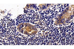Immunohistochemistry (IHC) image for anti-Interleukin 2 Receptor, alpha (IL2RA) (AA 22-213) antibody (ABIN7434179)