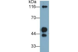 Detection of KNG1 in Human Plasma using Polyclonal Antibody to Kininogen 1 (KNG1) (KNG1 antibody  (AA 390-644))