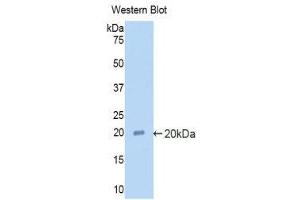 Western Blotting (WB) image for anti-Alpha2 Antiplasmin (SERPINF2) (AA 348-491) antibody (ABIN1857850) (alpha 2 Antiplasmin antibody  (AA 348-491))