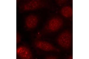 Immunofluorescence (IF) image for anti-Protein Kinase C, beta (PRKCB) (pThr641) antibody (ABIN1870521) (PKC beta antibody  (pThr641))